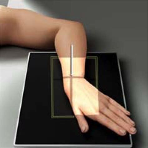 wrist ap position